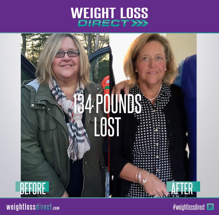 weight comparison before and after losing 134 pounds with weight loss direct