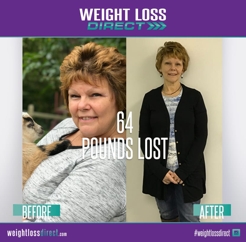 weight comparison before and after losing 64 pounds with weight loss direct