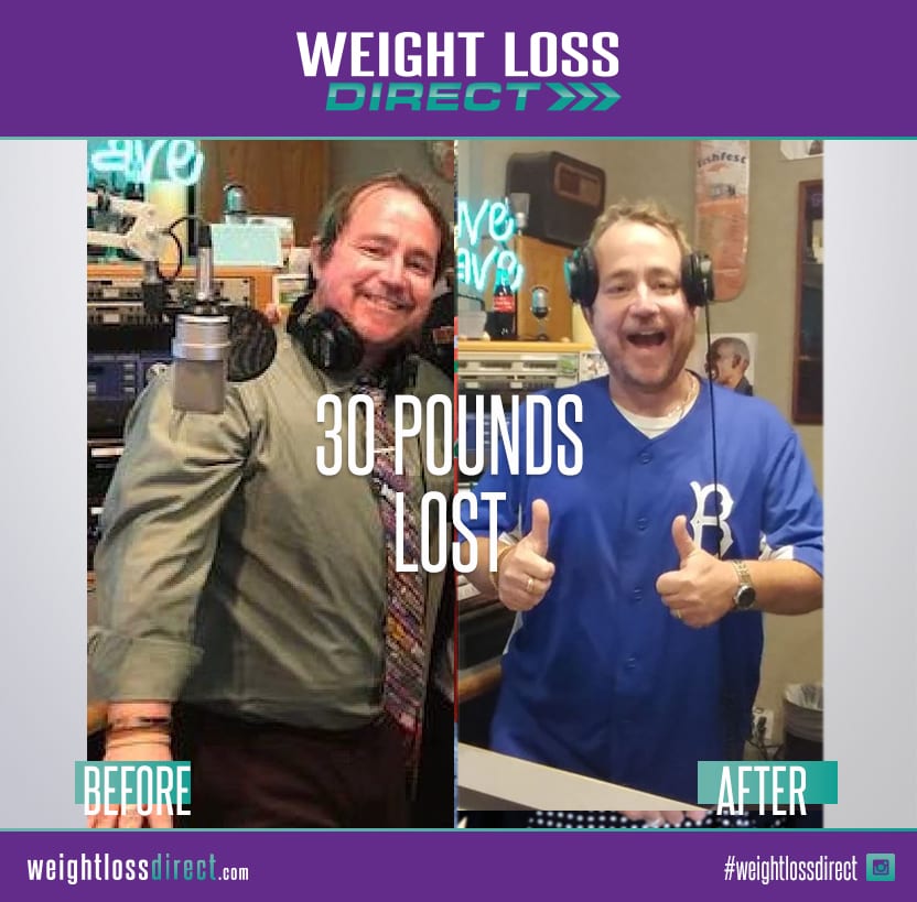 weight loss direct before and after picture 30 pounds lost